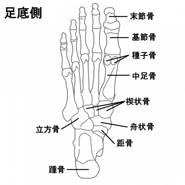 足底筋膜炎の一般的なアプローチ