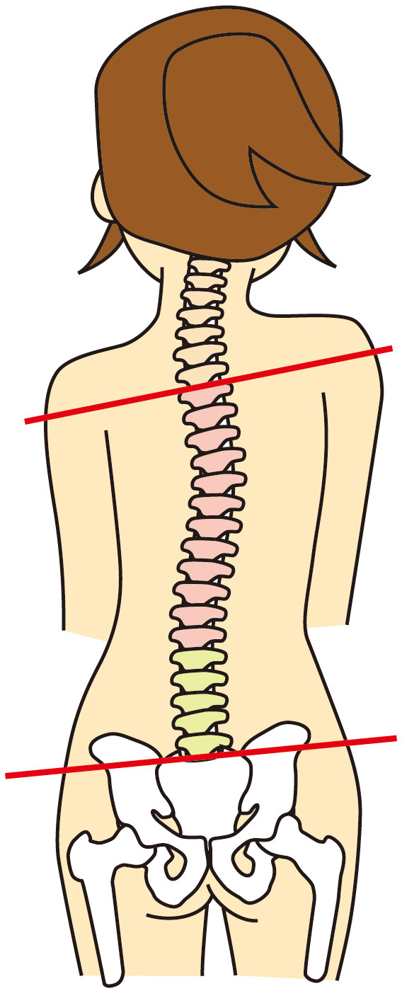 体の歪みは肩こりや腰痛の原因になります。